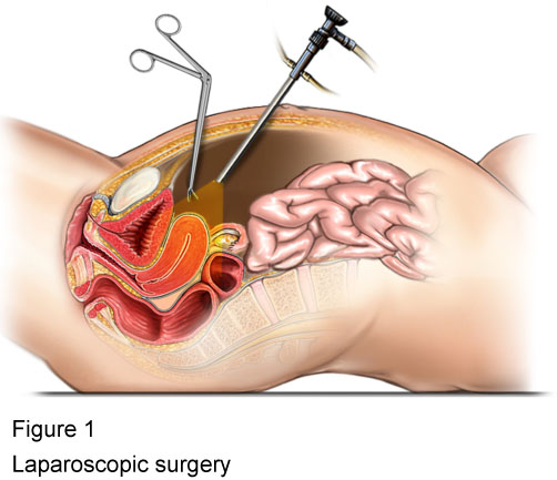 Gynecological: Problems and Conditions