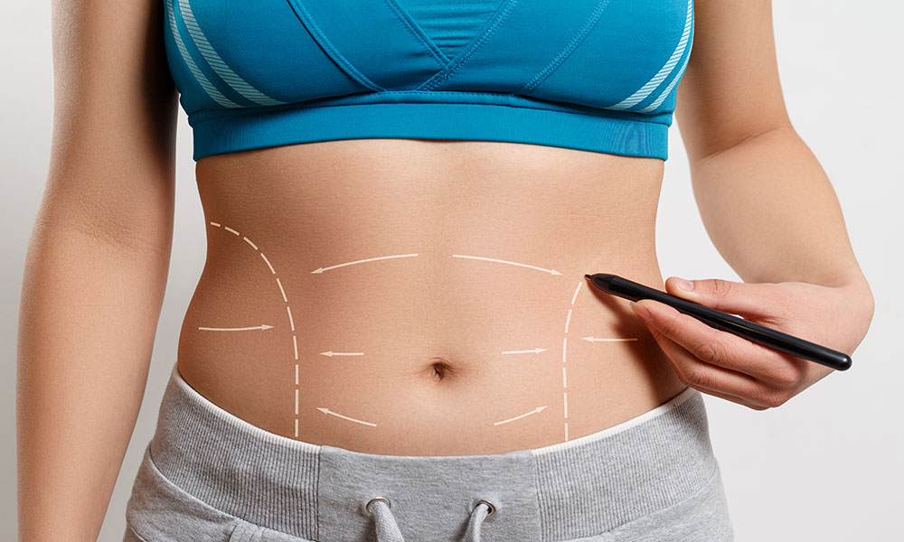 What are the benefits of tummy tuck surgery